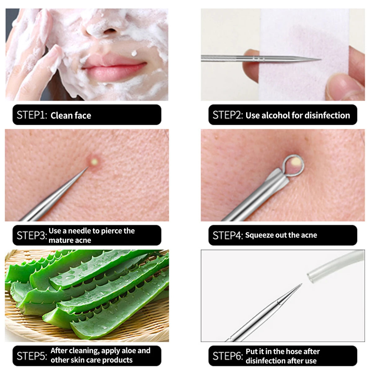 Acne Treatment Kit with Pore Cleanser Needle Hook - 4 Piece Set for Women's Skin Care