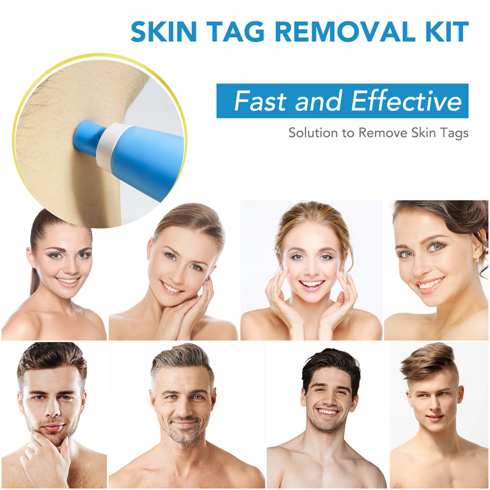 Dual-Ended Mole and Skin Tag Removal Pen Set - Pain-Free Wart and Skin Tag Removal Kit for Flawless Skin