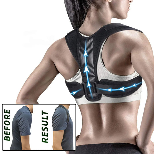 Posture Corrector for Humpback Prevention and Spine Pain Relief