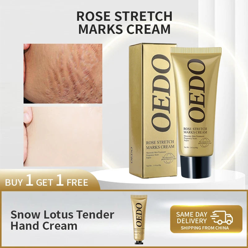 Rose Extract Stretch Mark Removal Cream - 40g